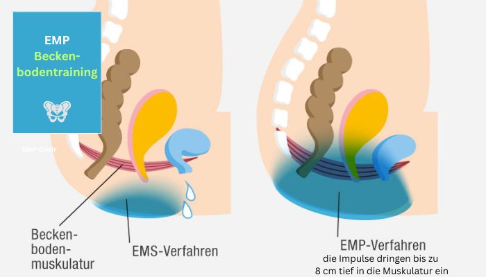 EMP Beckenbodentrainig und Physiotherapie