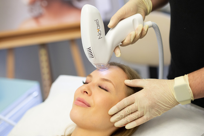 Mezotix®-Behandlung (Tixel®-Technologie) für eine Hautbildverbesserung im Gesicht